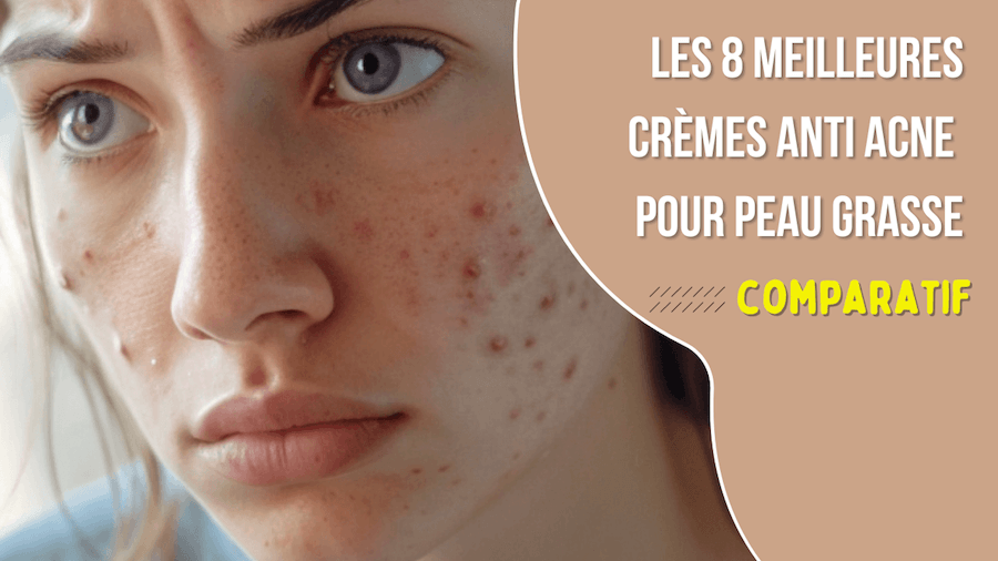 Meilleure creme acne